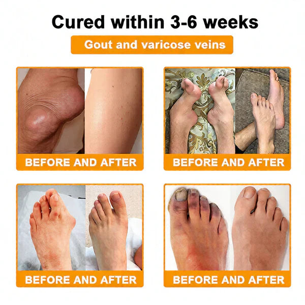 🏆50K+ SOLD LAST WEEK! 🌿LUMIVO™Bee Poison Pain-Relief Bone Healing Cream