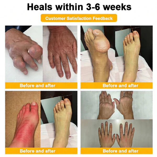 🏆50K+ SOLD LAST WEEK! 🌿LUMIVO™Bee Poison Pain-Relief Bone Healing Cream