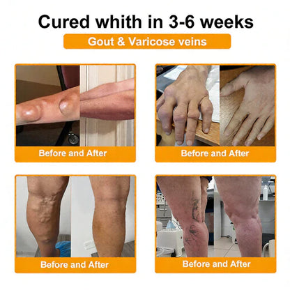 🏆50K+ SOLD LAST WEEK! 🌿LUMIVO™Bee Poison Pain-Relief Bone Healing Cream