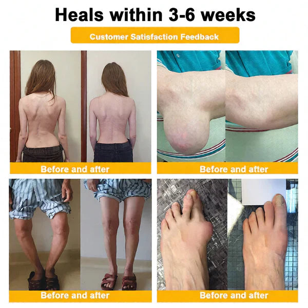 🏆50K+ SOLD LAST WEEK! 🌿LUMIVO™Bee Poison Pain-Relief Bone Healing Cream