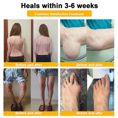🏆50K+ SOLD LAST WEEK! 🌿LUMIVO™Bee Poison Pain-Relief Bone Healing Cream