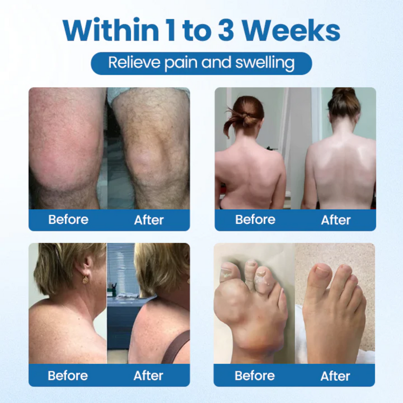 🚀 98.5% RECOMMEND! Deep-Penetrating Muscle Balm – Fast Relief for Arthritis, Back & Knee Pain-8CR5